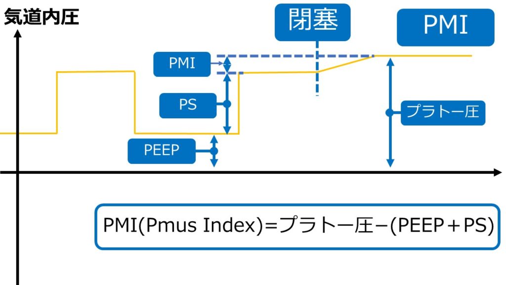 PMI(Pmus Index)